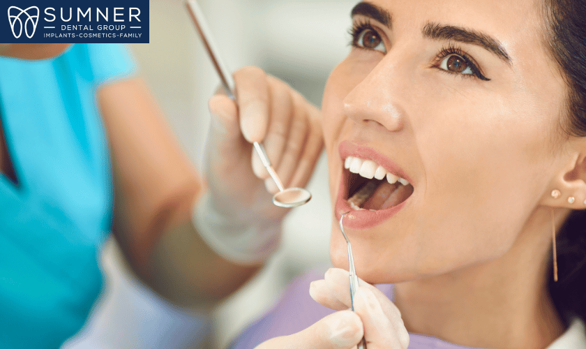 Dental Bonding in Gallatin