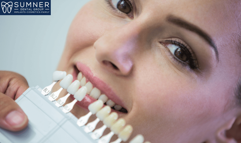 Dental Veneers in Gallatin