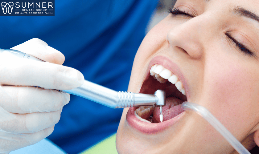 Implant Dentistry in Gallatin