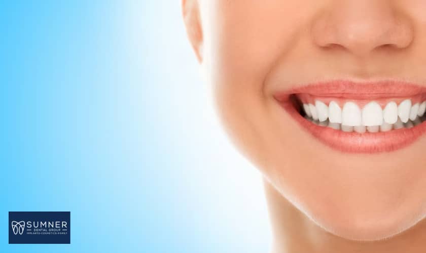 6 Benefits of Teeth Whitening