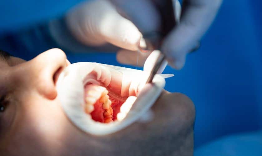 Oral Surgery in Gallatin, TN