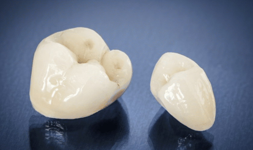 What To Do If Dental Crown Breaks