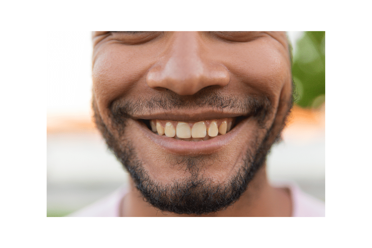 common causes of tooth stains