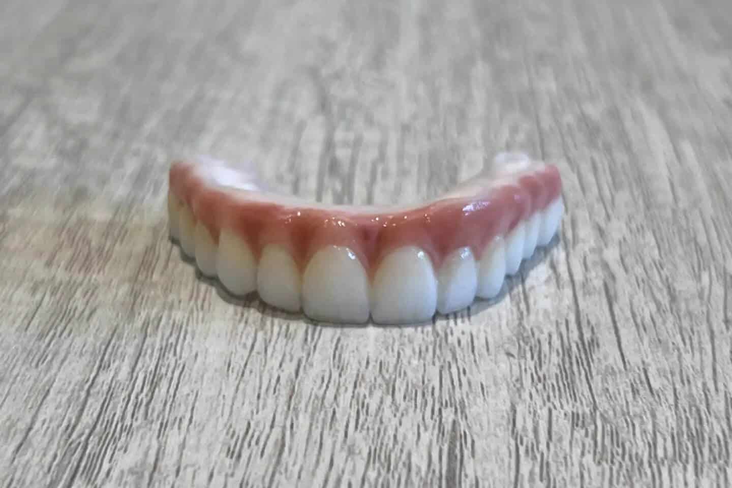 all-on-4 implants in gallatin