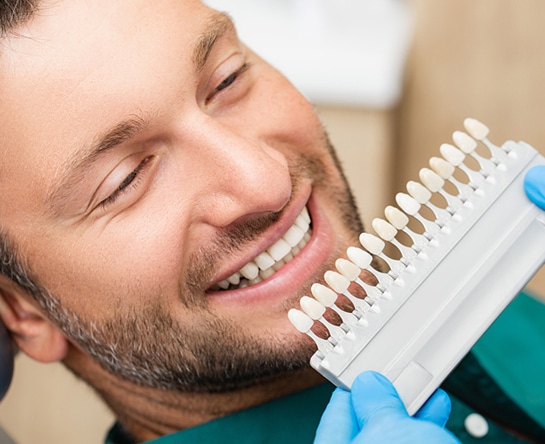 dental veneers gallatin