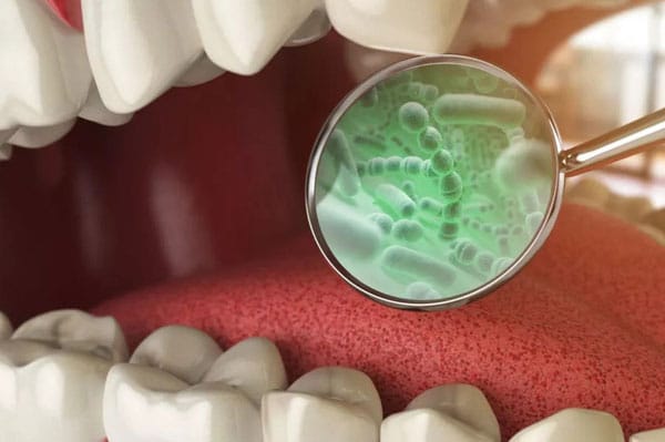 periodontal disease treatment