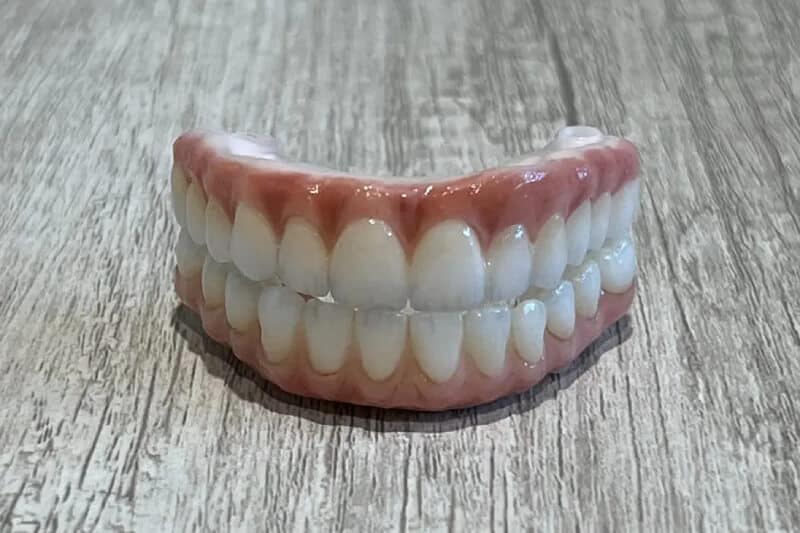 all-on-4 dental implants